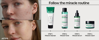 SOMEBYMI AHA-BHA-PHA 30 days Miracle Acne Clear Foam 100ml / 3.38 oz.