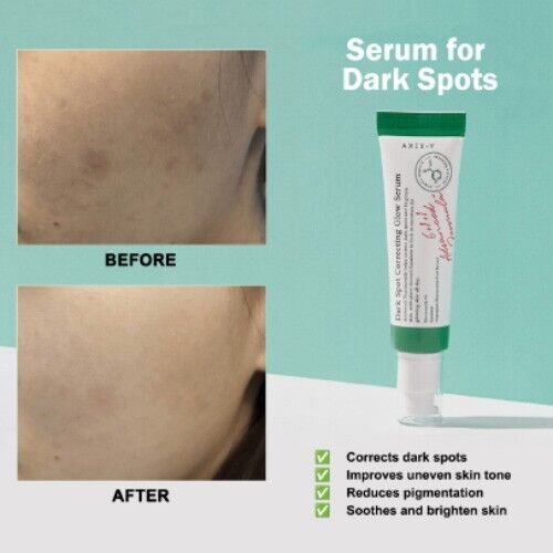 AXIS-Y Dark Spot Correcting Glow Serum 50ml / 1.69 fl. oz.